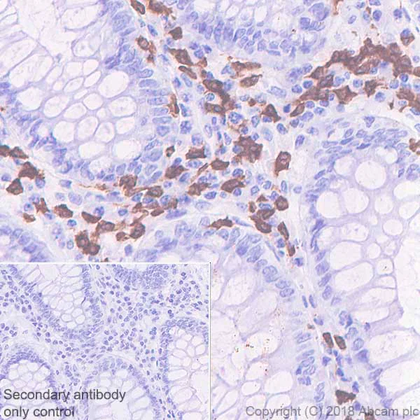 Anti-15 Lipoxygenase 1 antibody [EPR22138] (ab244205) | Abcam