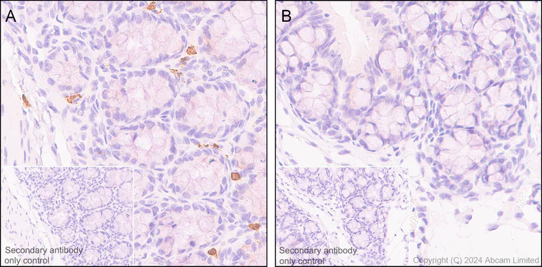 Immunohistochemistry (Formalin/PFA-fixed paraffin-embedded sections) - Anti-15 Lipoxygenase 1 antibody [EPR22138] (AB244205)