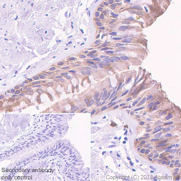 Anti-15 Lipoxygenase 1 antibody [EPR22138] (ab244205) | Abcam