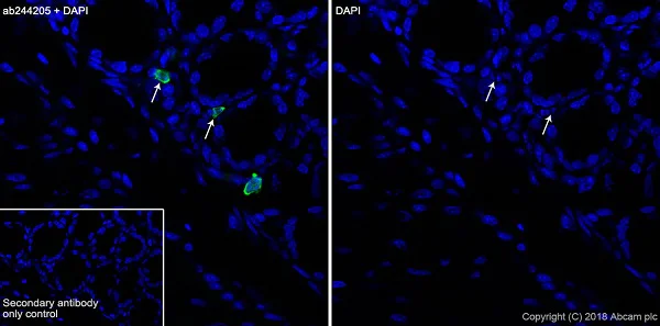 Immunohistochemistry (Frozen sections) - Anti-15 Lipoxygenase 1 antibody [EPR22138] (AB244205)