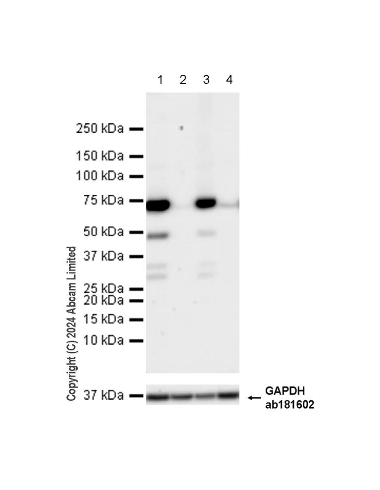 Western blot - Anti-15 Lipoxygenase 1 antibody [EPR22138] (AB244205)