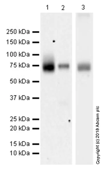 Western blot - Anti-15 Lipoxygenase 1 antibody [EPR22138] (AB244205)