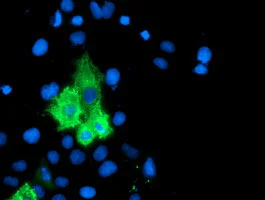Immunocytochemistry/ Immunofluorescence - Anti-15 Lipoxygenase 1 antibody [OTI3G8] (AB119774)