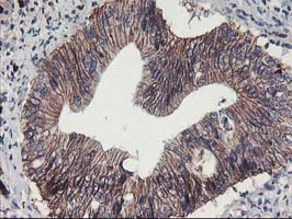 Immunohistochemistry (Formalin/PFA-fixed paraffin-embedded sections) - Anti-15 Lipoxygenase 1 antibody [OTI3G8] (AB119774)