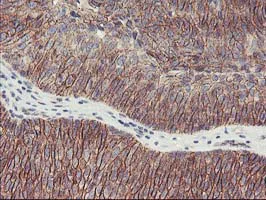 Immunohistochemistry (Formalin/PFA-fixed paraffin-embedded sections) - Anti-15 Lipoxygenase 1 antibody [OTI3G8] (AB119774)