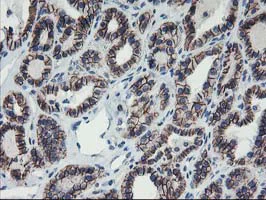 Immunohistochemistry (Formalin/PFA-fixed paraffin-embedded sections) - Anti-15 Lipoxygenase 1 antibody [OTI3G8] (AB119774)