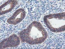 Immunohistochemistry (Formalin/PFA-fixed paraffin-embedded sections) - Anti-15 Lipoxygenase 1 antibody [OTI3G8] (AB119774)