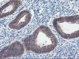 Immunohistochemistry (Formalin/PFA-fixed paraffin-embedded sections) - Anti-15 Lipoxygenase 1 antibody [OTI3G8] (AB119774)