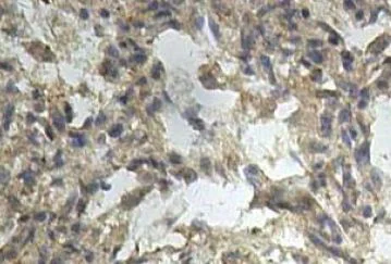 Immunohistochemistry (Formalin/PFA-fixed paraffin-embedded sections) - Anti-15-LOX-2 antibody (AB113488)