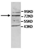 Western blot - Anti-15-LOX-2 antibody (AB113488)