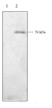 Anti-15-LOX-2 antibody (ab23691) | Abcam