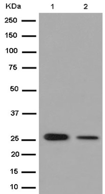 Western blot - Anti-15-PGDH antibody [EPR14332-19] - BSA and Azide free (AB232625)