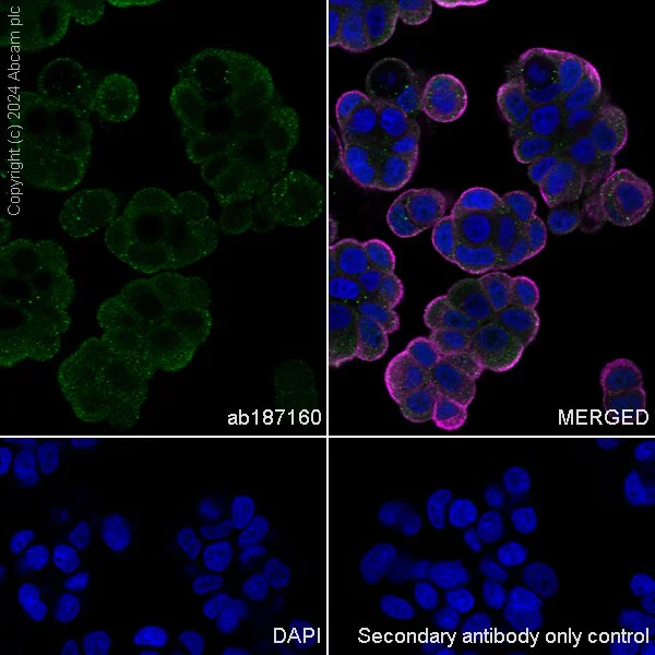 Immunocytochemistry/ Immunofluorescence - Anti-15-PGDH antibody [EPR14332] (AB187160)