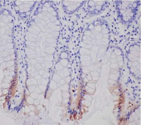 Immunohistochemistry (Formalin/PFA-fixed paraffin-embedded sections) - Anti-15-PGDH antibody [EPR14332] - BSA and Azide free (AB243942)
