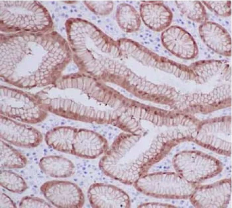 Immunohistochemistry (Formalin/PFA-fixed paraffin-embedded sections) - Anti-15-PGDH antibody [EPR14332] - BSA and Azide free (AB243942)