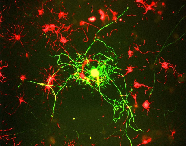 Immunocytochemistry/ Immunofluorescence - Anti-160 kD Neurofilament Medium antibody [3A11] - Neuronal Marker (AB254125), expandable thumbnail