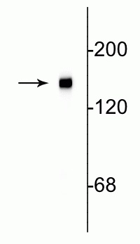 Western blot - Anti-160 kD Neurofilament Medium antibody [3A11] - Neuronal Marker (AB254125), expandable thumbnail