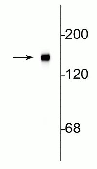 Western blot - Anti-160 kD Neurofilament Medium antibody [3A11] - Neuronal Marker (AB254125)