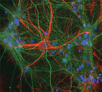 Immunocytochemistry/ Immunofluorescence - Anti-160 kD Neurofilament Medium antibody (AB134458), expandable thumbnail