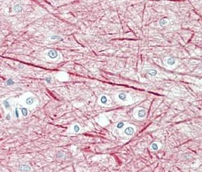 Immunohistochemistry (Formalin/PFA-fixed paraffin-embedded sections) - Anti-160 kD Neurofilament Medium antibody (AB195658)