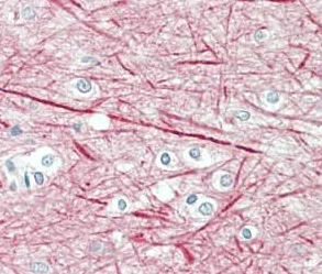 Immunohistochemistry (Formalin/PFA-fixed paraffin-embedded sections) - Anti-160 kD Neurofilament Medium antibody (AB195658)