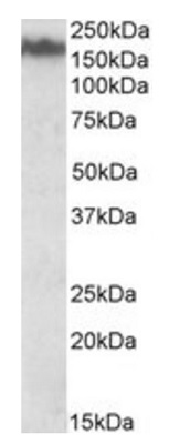 Western blot - Anti-160 kD Neurofilament Medium antibody (AB195658)