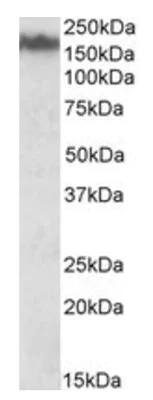 Western blot - Anti-160 kD Neurofilament Medium antibody (AB195658)