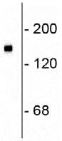 Western blot - Anti-160 kD Neurofilament Medium antibody (AB72998)