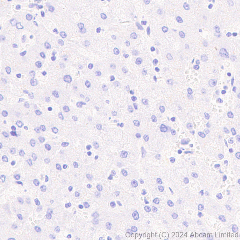 Immunohistochemistry (Formalin/PFA-fixed paraffin-embedded sections) - Anti-160 kD Neurofilament Medium antibody [EP2460] - BSA and Azide free (AB247580)