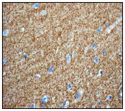 Immunohistochemistry (Formalin/PFA-fixed paraffin-embedded sections) - Anti-160 kD Neurofilament Medium antibody [EP2460] (ab92539), expandable thumbnail