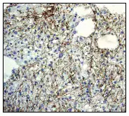 Immunohistochemistry (Formalin/PFA-fixed paraffin-embedded sections) - Anti-160 kD Neurofilament Medium antibody [EP2460] (ab92539), expandable thumbnail