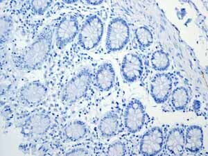 Immunohistochemistry (Formalin/PFA-fixed paraffin-embedded sections) - Anti-160 kD Neurofilament Medium antibody [EP2460] (ab92539), expandable thumbnail