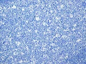 Immunohistochemistry (Formalin/PFA-fixed paraffin-embedded sections) - Anti-160 kD Neurofilament Medium antibody [EP2460] (ab92539), expandable thumbnail