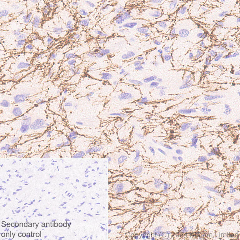 Immunohistochemistry (Formalin/PFA-fixed paraffin-embedded sections) - Anti-160 kD Neurofilament Medium antibody [EP2460] - Neuronal Marker (AB92539)