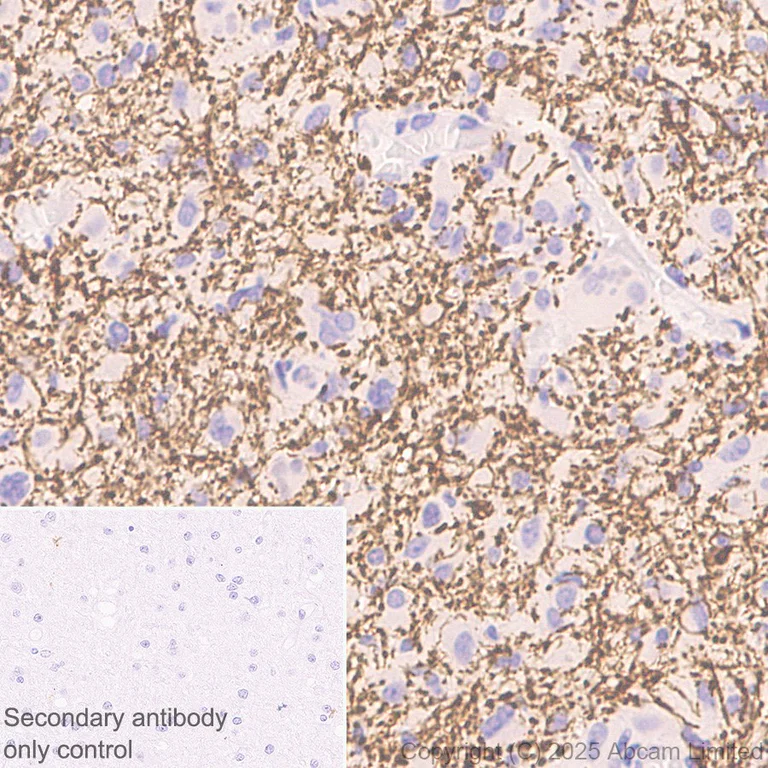 Immunohistochemistry (Formalin/PFA-fixed paraffin-embedded sections) - Anti-160 kD Neurofilament Medium antibody [EP2460] - Neuronal Marker (AB92539)