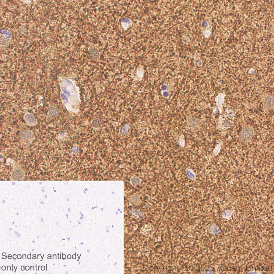 Immunohistochemistry (Formalin/PFA-fixed paraffin-embedded sections) - Anti-160 kD Neurofilament Medium antibody [EP2460] - Neuronal Marker (AB92539)