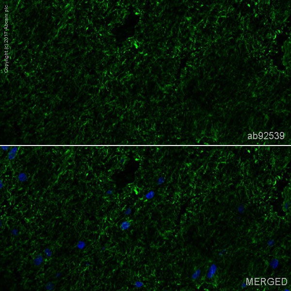 Immunohistochemistry (Frozen sections) - Anti-160 kD Neurofilament Medium antibody [EP2460] (ab92539), expandable thumbnail