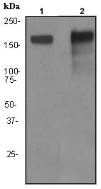 Western blot - Anti-160 kD Neurofilament Medium antibody [EP2460] - Neuronal Marker (AB92539), expandable thumbnail
