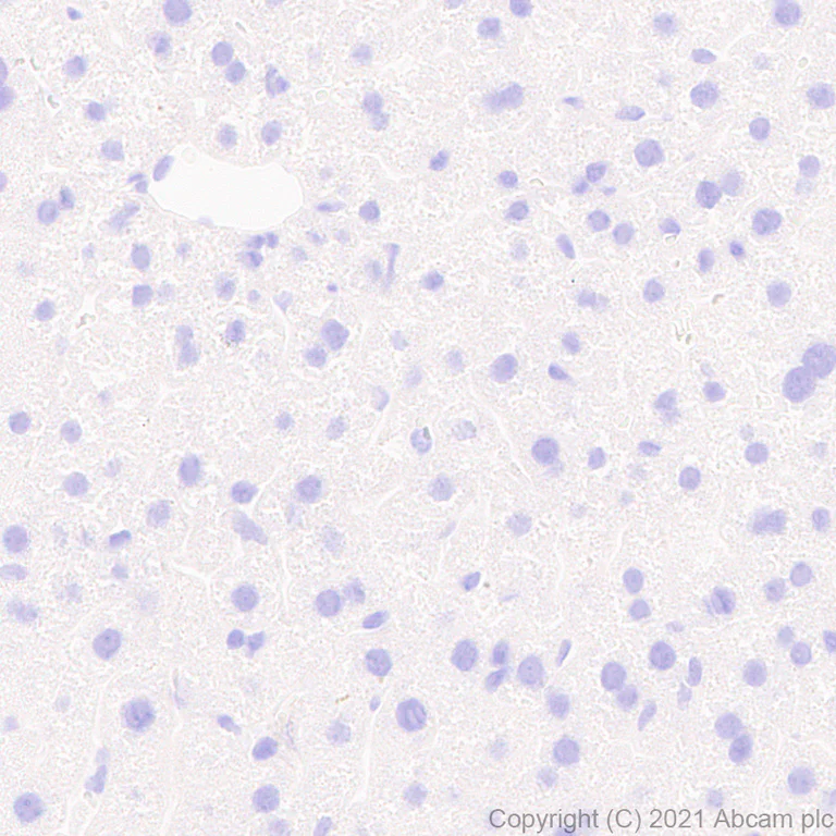Immunohistochemistry (Formalin/PFA-fixed paraffin-embedded sections) - Anti-160 kD Neurofilament Medium antibody [EPR23510-76] - BSA and Azide free (AB281830)