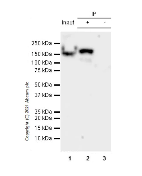Immunoprecipitation - Anti-160 kD Neurofilament Medium antibody [EPR23510-76] - BSA and Azide free (AB281830)