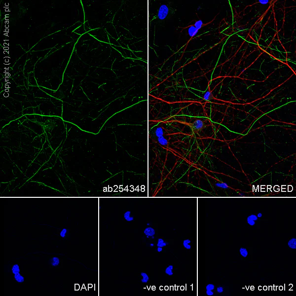 Immunocytochemistry/ Immunofluorescence - Anti-160 kD Neurofilament Medium antibody [EPR23510-76] - Neuronal Marker (AB254348)