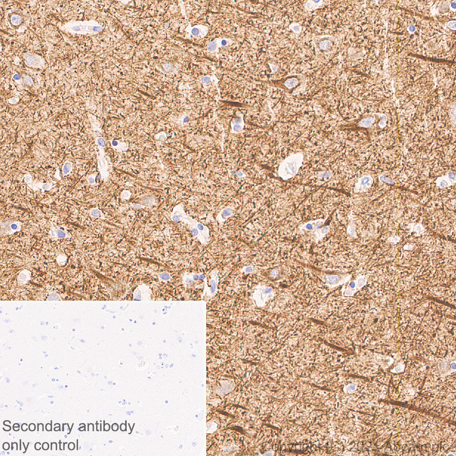 Immunohistochemistry (Formalin/PFA-fixed paraffin-embedded sections) - Anti-160 kD Neurofilament Medium antibody [EPR23510-76] - Neuronal Marker (ab254348), expandable thumbnail