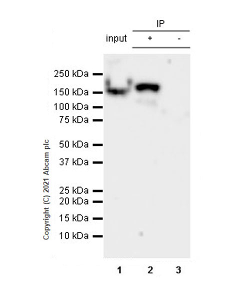 Immunoprecipitation - Anti-160 kD Neurofilament Medium antibody [EPR23510-76] - Neuronal Marker (ab254348), expandable thumbnail