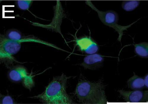 Immunocytochemistry/ Immunofluorescence - Anti-160 kD Neurofilament Medium antibody [NF-09] - Neuronal Marker (AB7794)