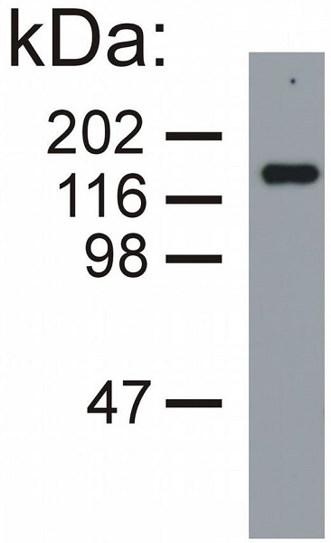 Western blot - Anti-160 kD Neurofilament Medium antibody [NF-09] - Neuronal Marker (AB7794), expandable thumbnail