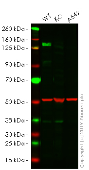 Western blot - Anti-160 kD Neurofilament Medium antibody [NF-09] - Neuronal Marker (AB7794), expandable thumbnail