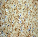 Immunohistochemistry (Formalin/PFA-fixed paraffin-embedded sections) - Anti-160 kD Neurofilament Medium (phospho S614 + S619) antibody [EPR580(2)Y] (AB68142), expandable thumbnail