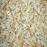 Immunohistochemistry (Formalin/PFA-fixed paraffin-embedded sections) - Anti-160 kD Neurofilament Medium (phospho S614 + S619) antibody [EPR580(2)Y] (AB68142)