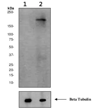 Western blot - Anti-160 kD Neurofilament Medium (phospho S614 + S619) antibody [EPR580(2)Y] (AB68142)