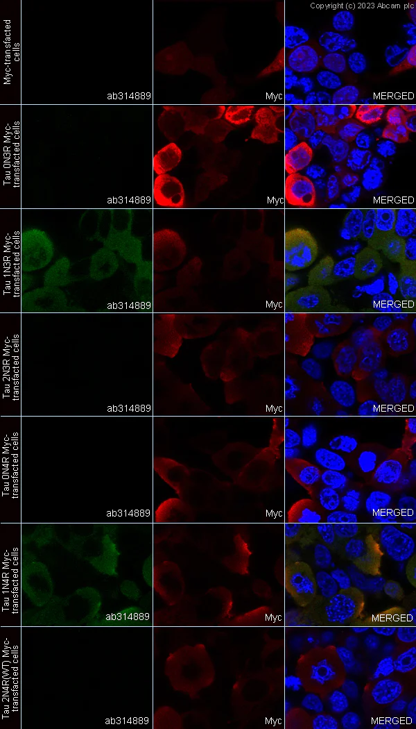 Immunocytochemistry/ Immunofluorescence - Anti-1N Tau antibody [EPR25206-82] (AB314889)